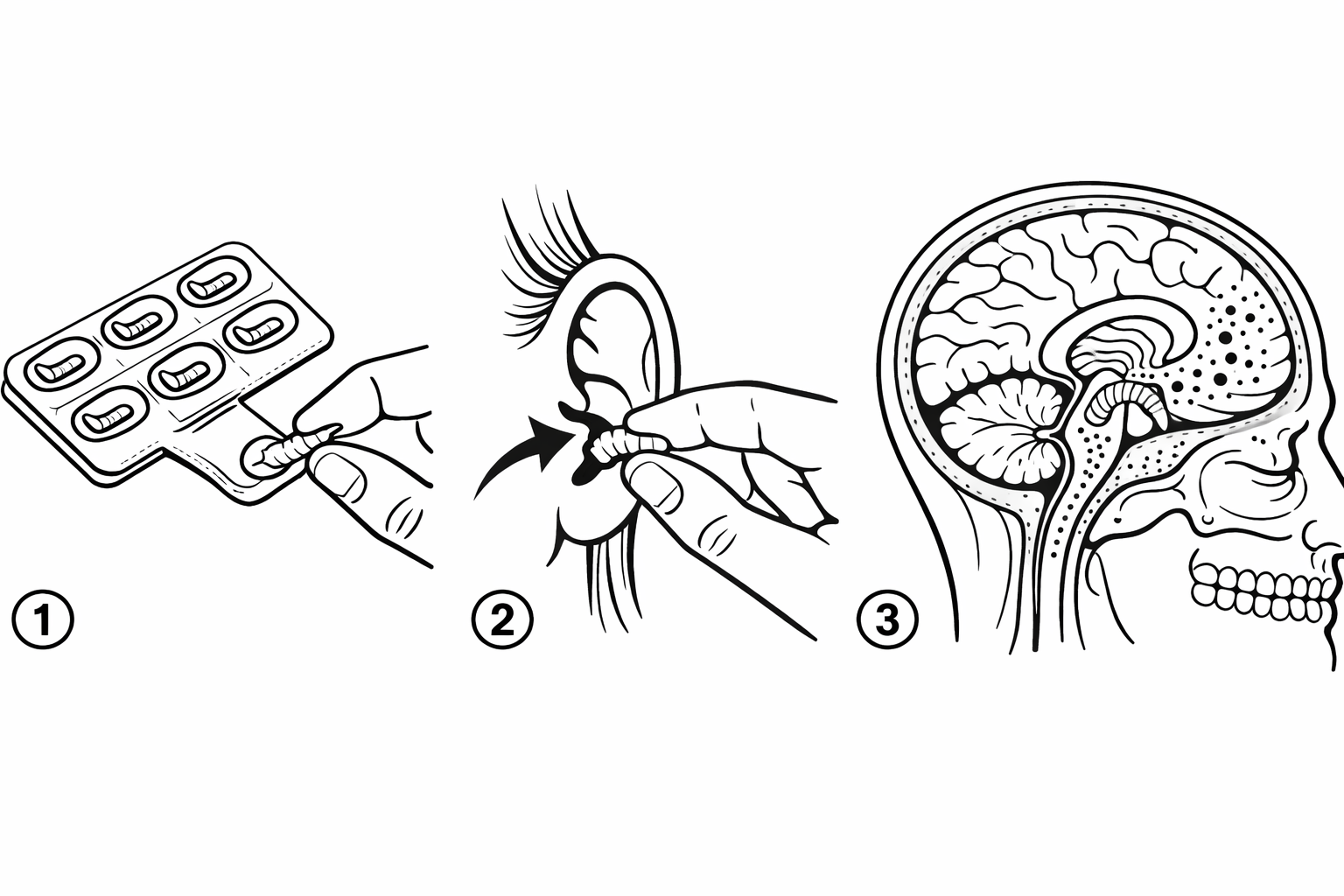 Schematische Anleitung zur Anwendung von Mentabolin mit Ohrwurm-Applikation
